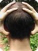 acupressure100x130.jpg