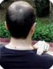 acupressure1_100x130.jpg