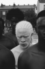 black albino.png