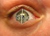 stock-photo-1254198-match-in-eye.jpg