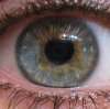 central-heterochromia-m.jpg